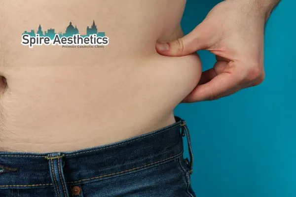 Why do we get love handles Sherborne and how can we minimise them?