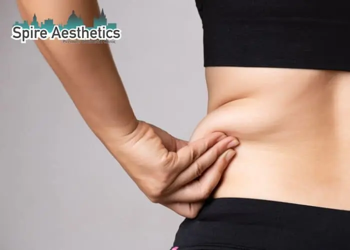 Image of woman pinching fat on their hips Sherborne. Fat Freezing treatment